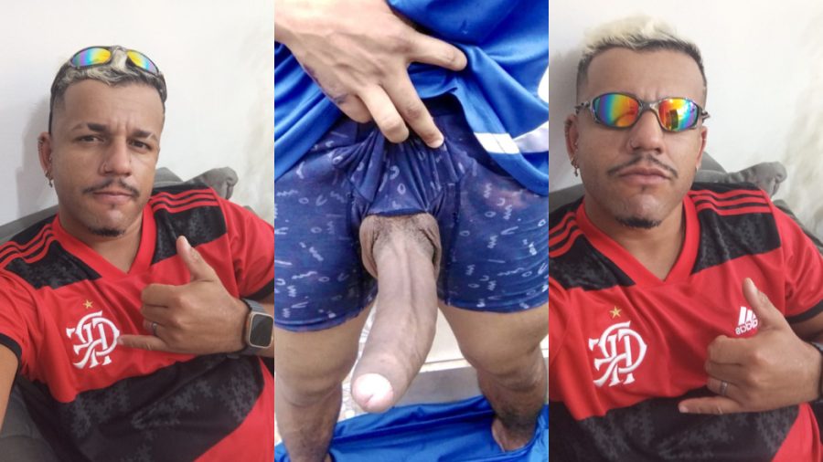 Caio Malvacinni 100