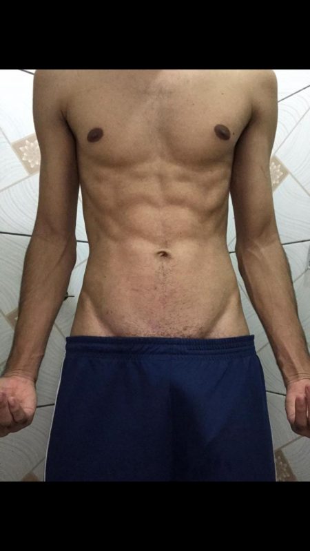 Anderson Fernandes 1