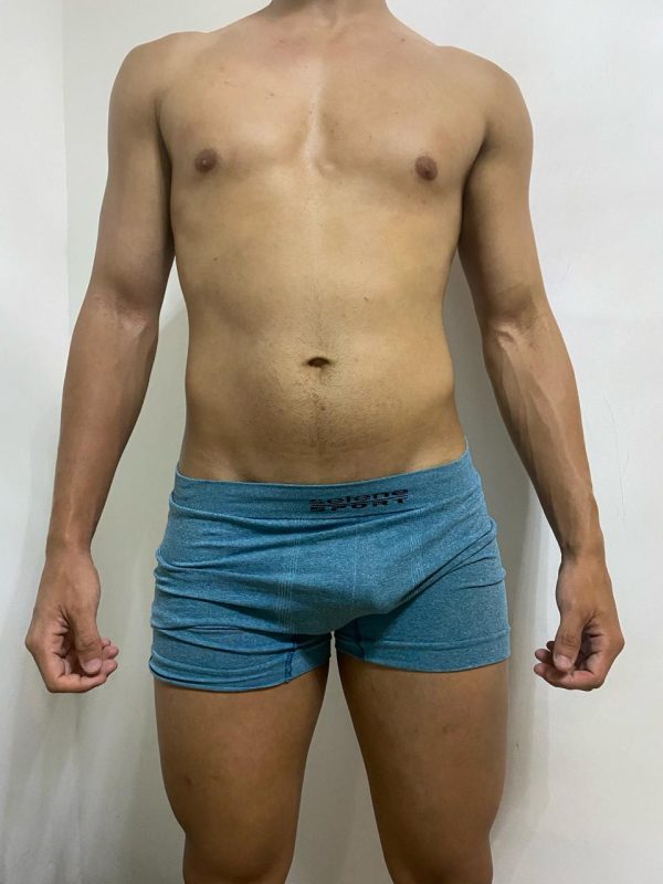 Lauro de Freitas