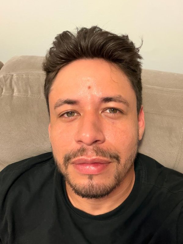 Parrudo Dotado 3