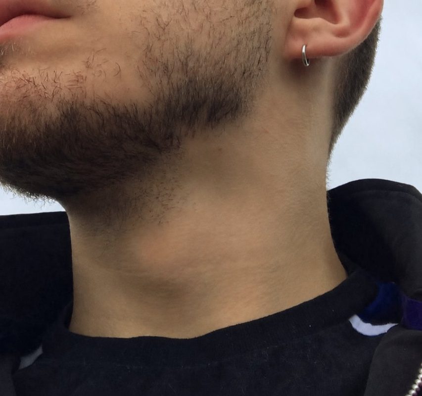 Thiago Pira 1