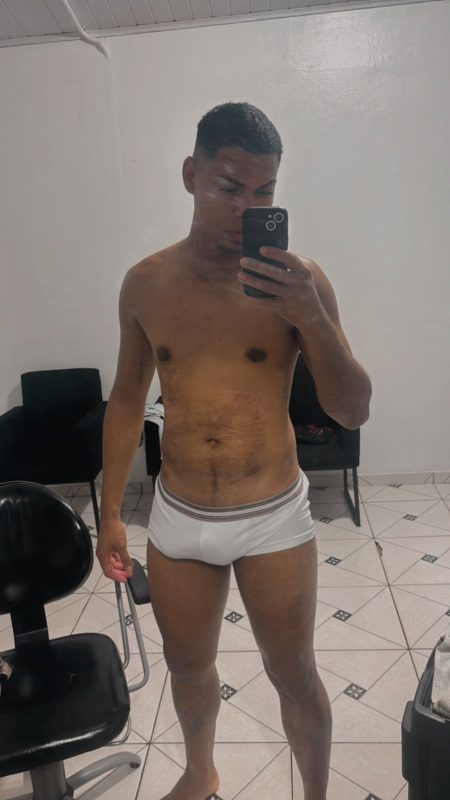 Put Dot24cm Grosso 10