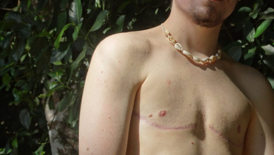 Tyler Gus - Homem Trans