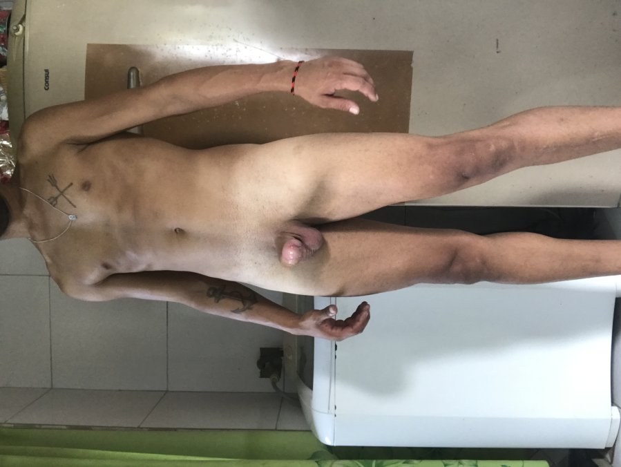 Lucas Fernandes 6