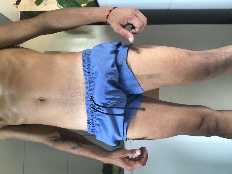 Lucas Fernandes 4