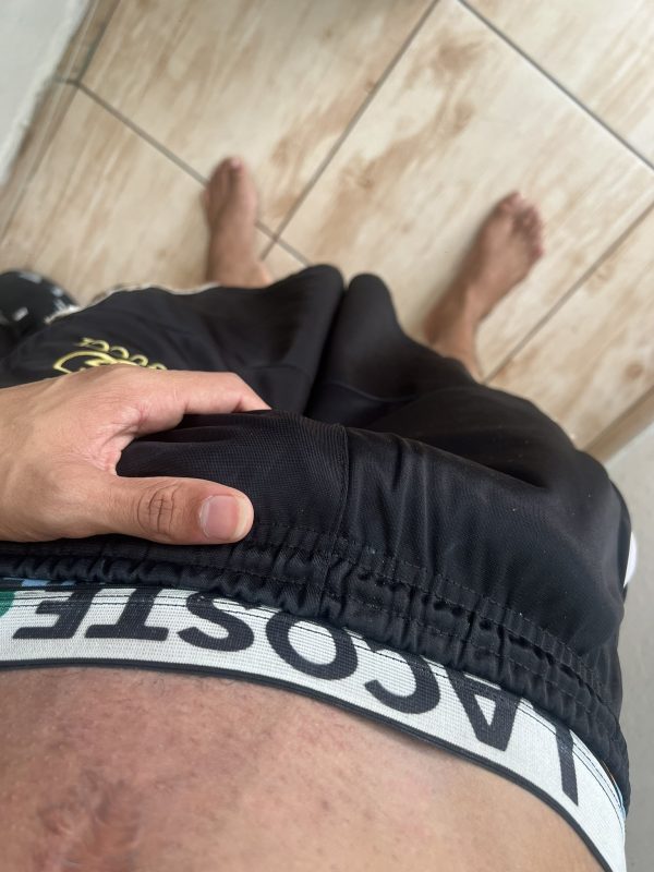 Mlk Dotado 1