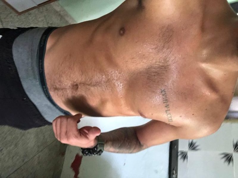 Ativo Posturado 16