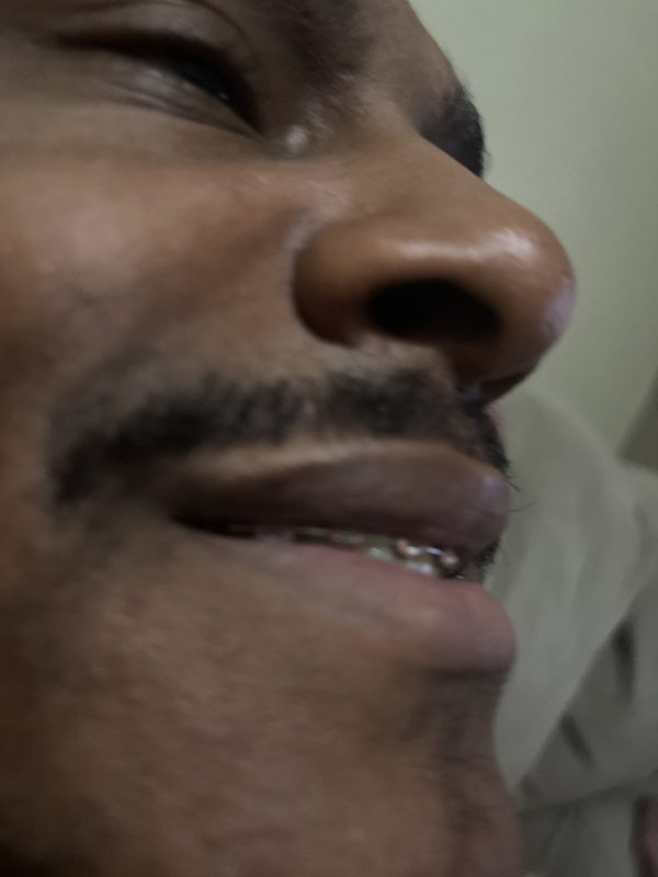 Pretão Disposto 7